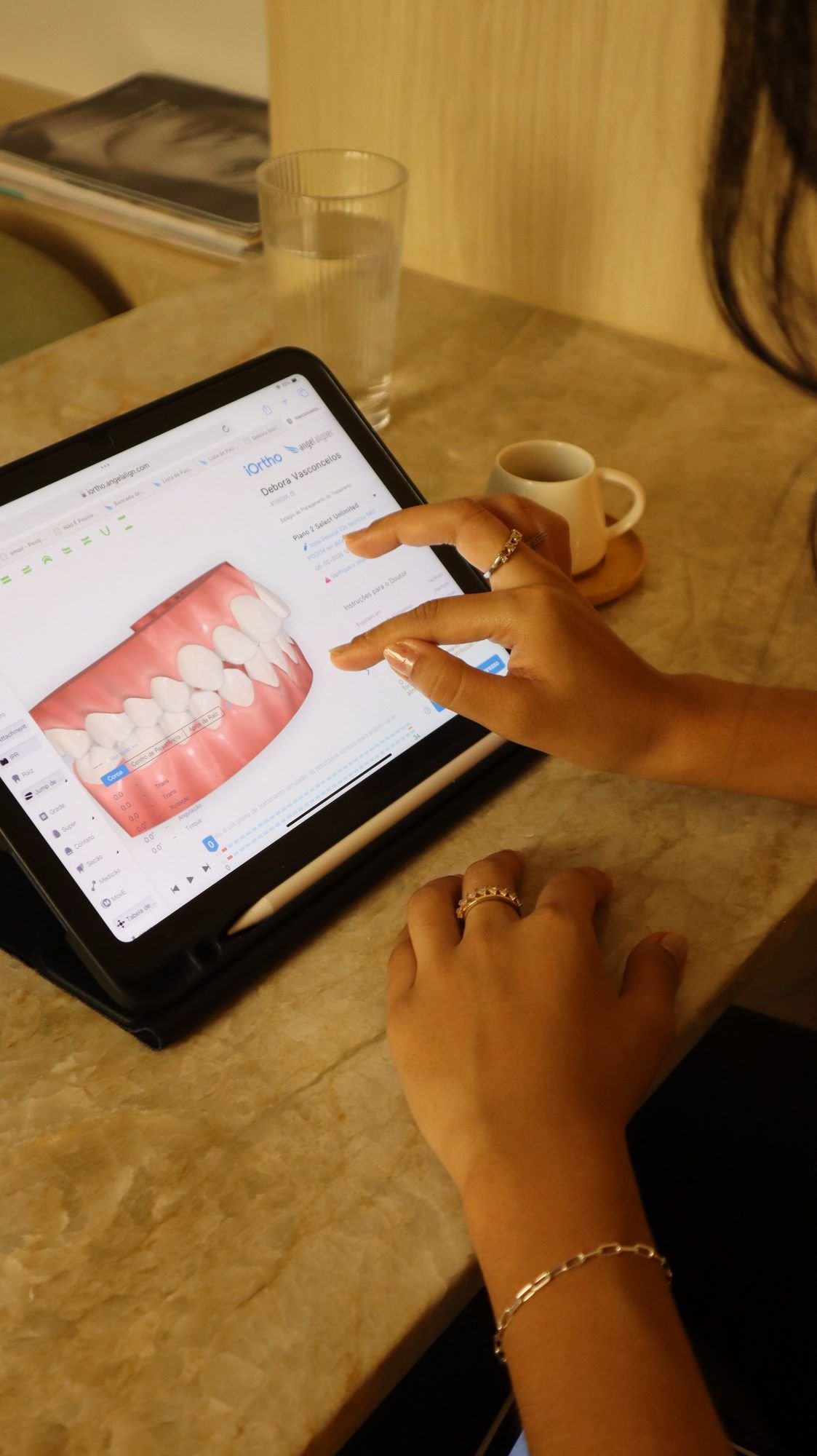 Mãos da Dra. Débora usando um tablet com a simulação digital do alinhamento dos dentes